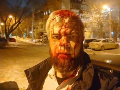 В Челябинске избили адвоката, требующего лишить мандата местного депутата-единоросса