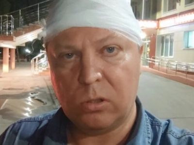 Глава СКР взял под контроль нападение на депутата Матвеева в Самаре